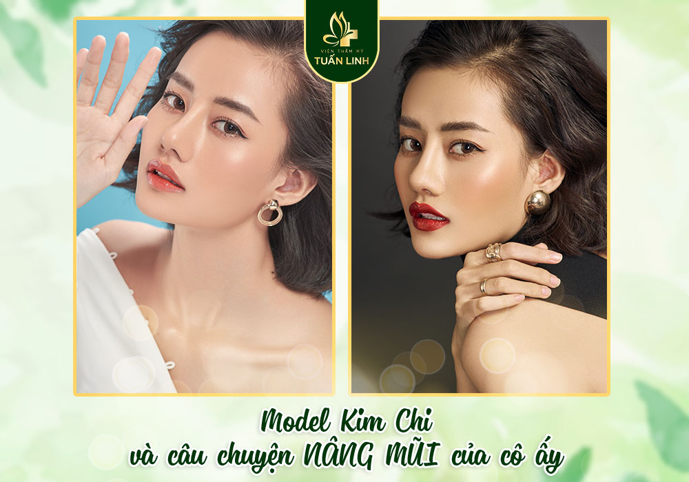 Model Kim Chi và câu chuyện NÂNG MŨI của cô ấy