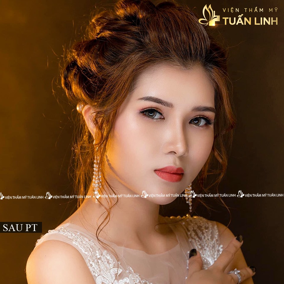 khach hang sau nang mui moi9