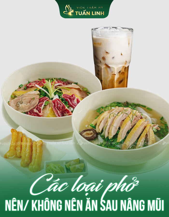 Các loại phở nên/ không nên ăn sau nâng mũi
