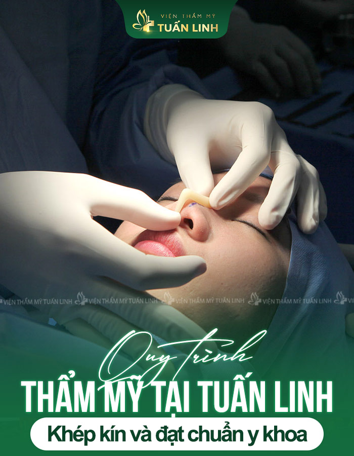 Quy trình thẩm mỹ tại Tuấn Linh khép kín và đạt chuẩn y khoa