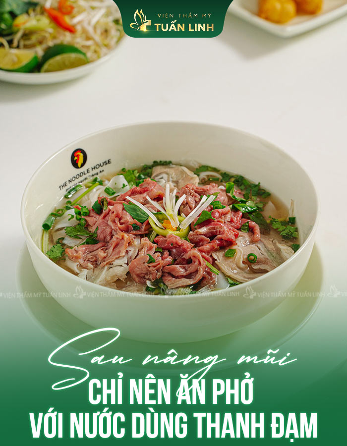 Sau nâng mũi chỉ nên ăn phở với nước dùng thanh đạm