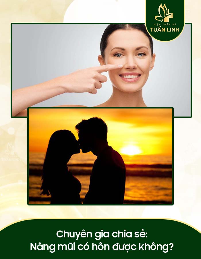 Chuyên gia chia sẻ: Nâng mũi có hôn được không?