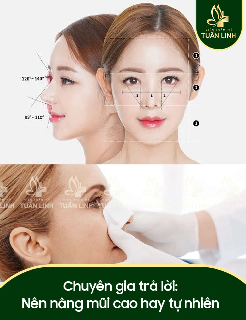 Chuyên gia trả lời: Nên nâng mũi cao hay tự nhiên