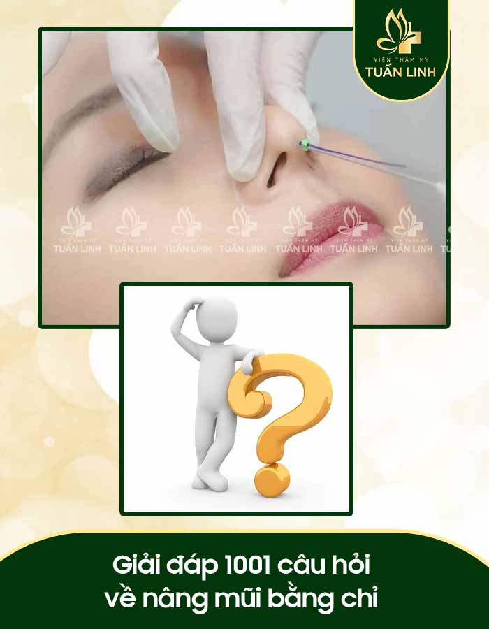 Giải đáp 1001 câu hỏi về nâng mũi bằng chỉ