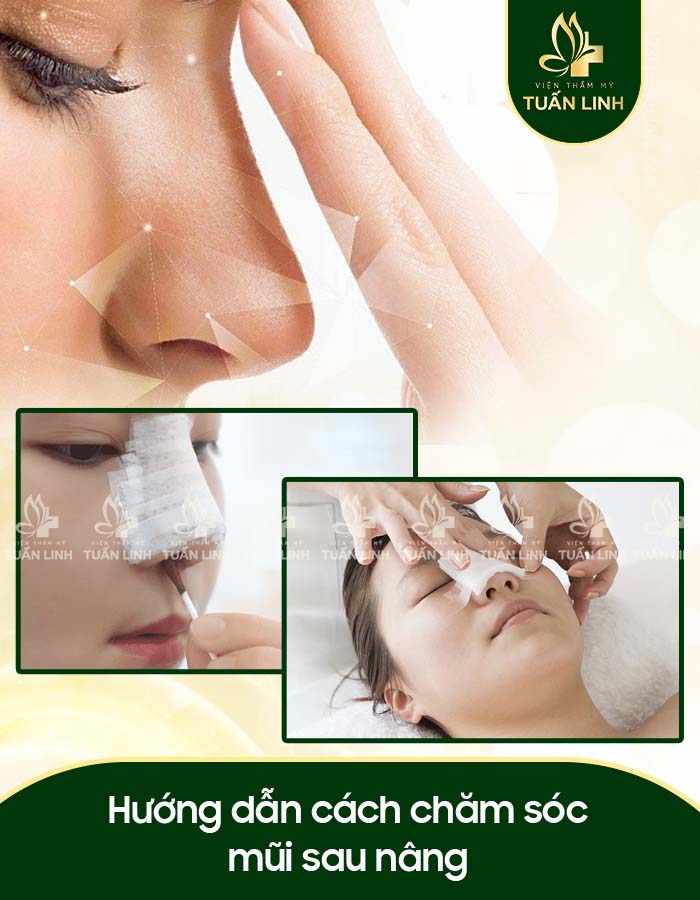 Hướng dẫn cách chăm sóc mũi sau nâng