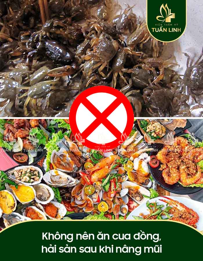 Không nên ăn cua đồng, hải sản sau khi nâng mũi