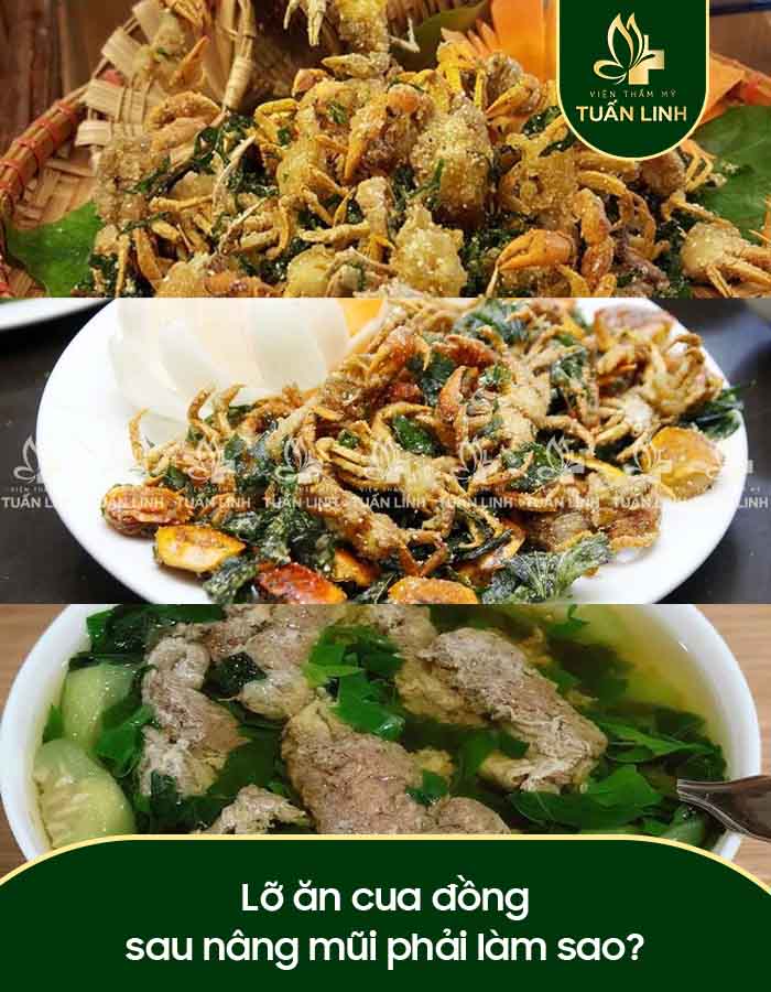 Lỡ ăn cua đồng sau nâng mũi phải làm sao?