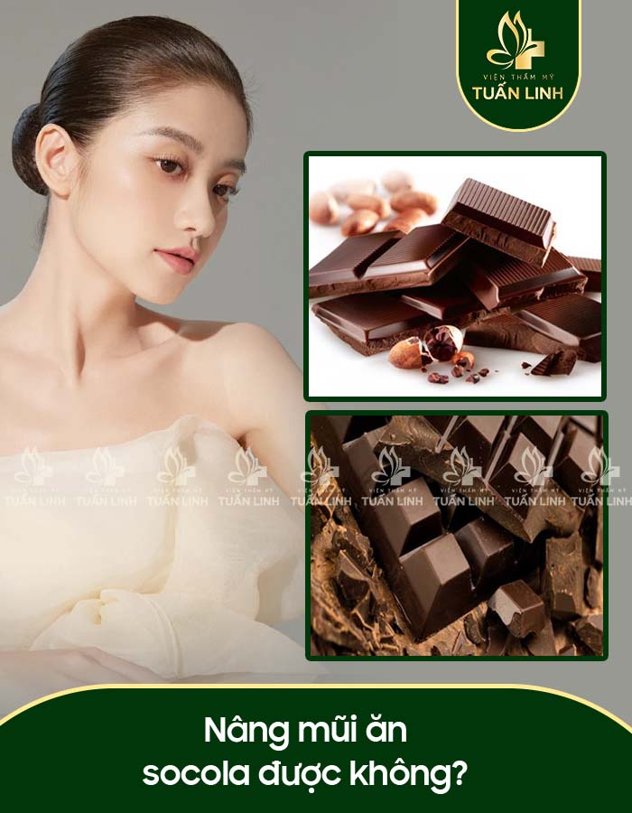 Nâng mũi ăn socola được không?