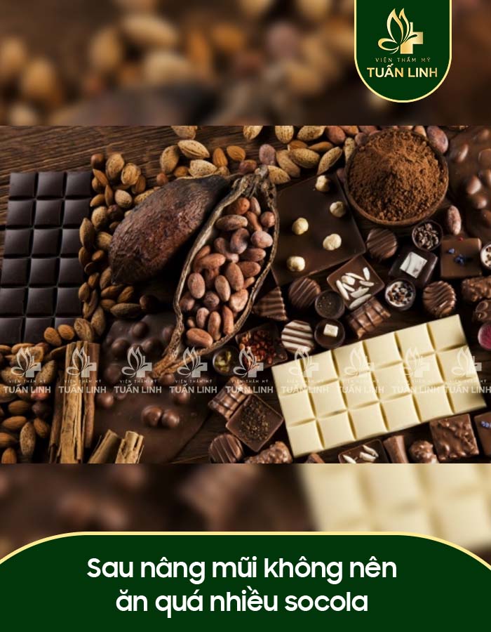 Sau nâng mũi không nên ăn quá nhiều socola