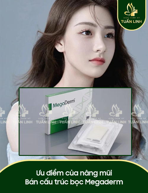 Ưu điểm của nâng mũi Bán cấu trúc bọc Megaderm