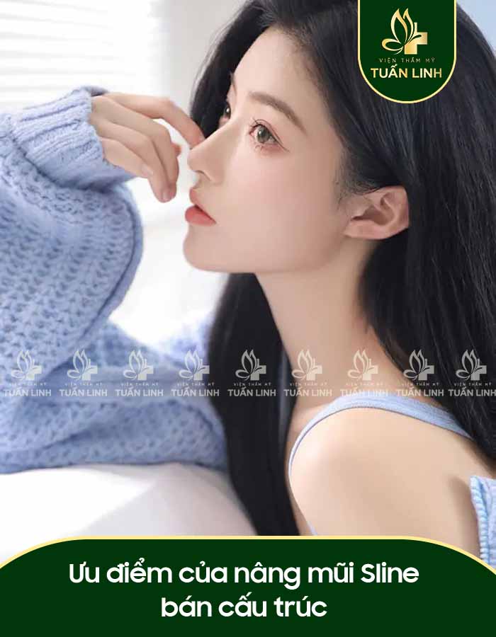 Ưu điểm của nâng mũi Sline bán cấu trúc