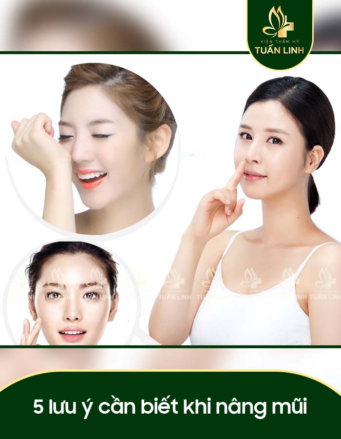 5 lưu ý cần biết khi nâng mũi
