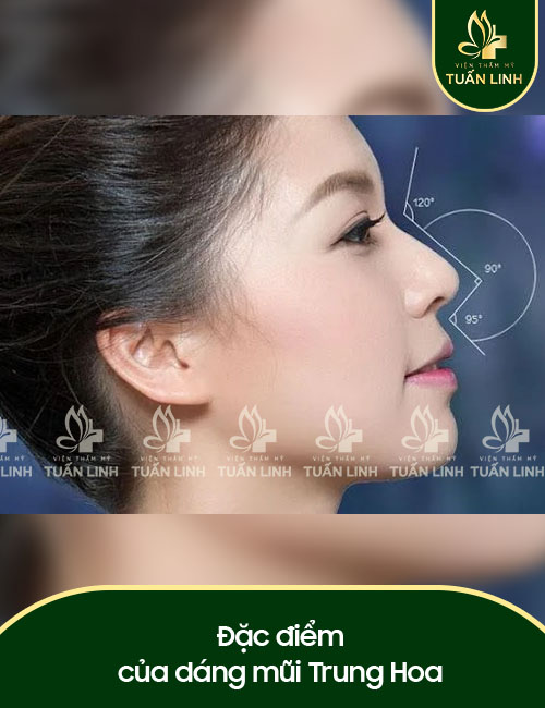 Đặc điểm của dáng mũi Trung Hoa