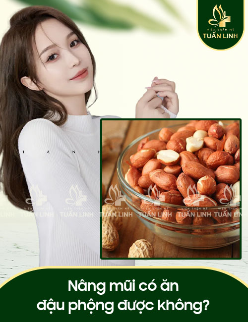 Nâng mũi có ăn đậu phộng được không?
