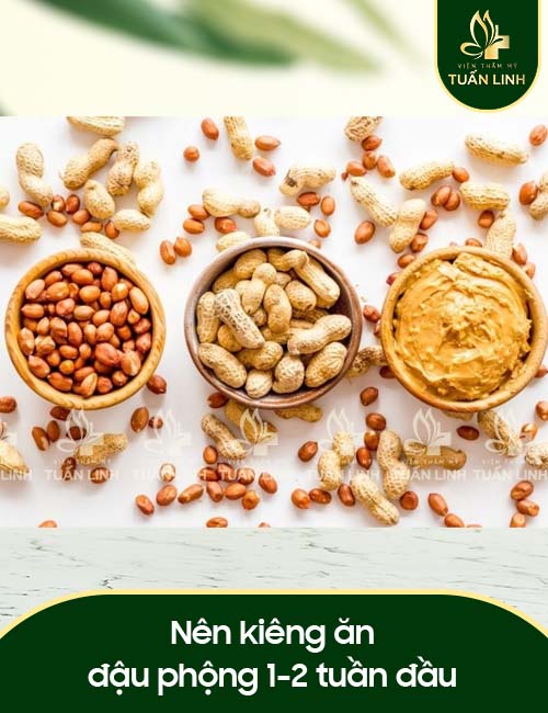 Nên kiêng ăn đậu phộng 1-2 tuần đầu