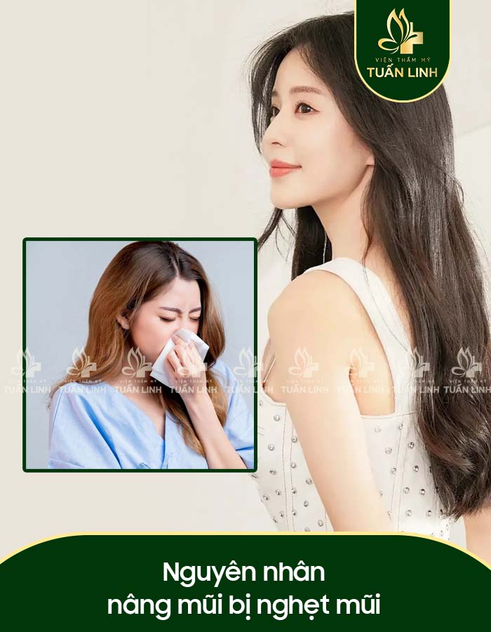 Nguyên nhân nâng mũi bị nghẹt mũi
