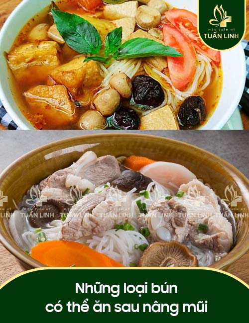 Những loại bún có thể ăn sau nâng mũi