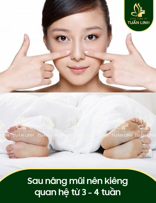 Sau nâng mũi nên kiêng quan hệ từ 3 - 4 tuần
