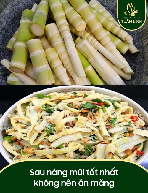 Sau nâng mũi tốt nhất không nên ăn măng