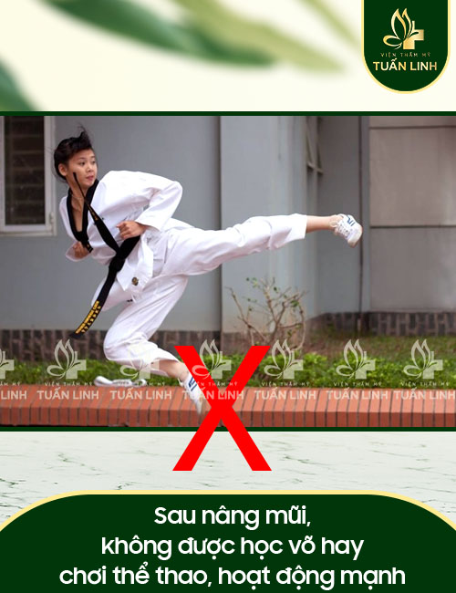 Sau nâng mũi, không được học võ hay chơi thể thao, hoạt động mạnh