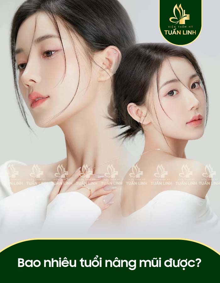 Bao nhiêu tuổi nâng mũi được?