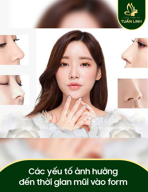 Các yếu tố ảnh hưởng đến thời gian mũi vào phom