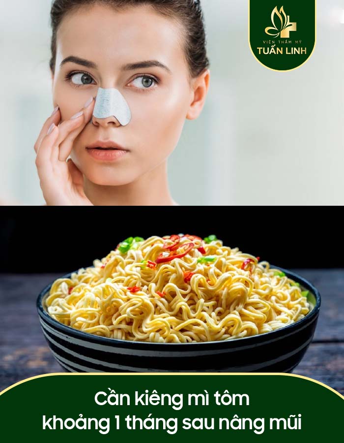 Cần kiêng mì tôm khoảng 1 tháng sau nâng mũi