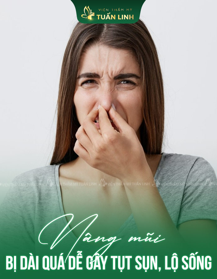 Nâng mũi bị dài quá dễ gây tụt sụn, lộ sống