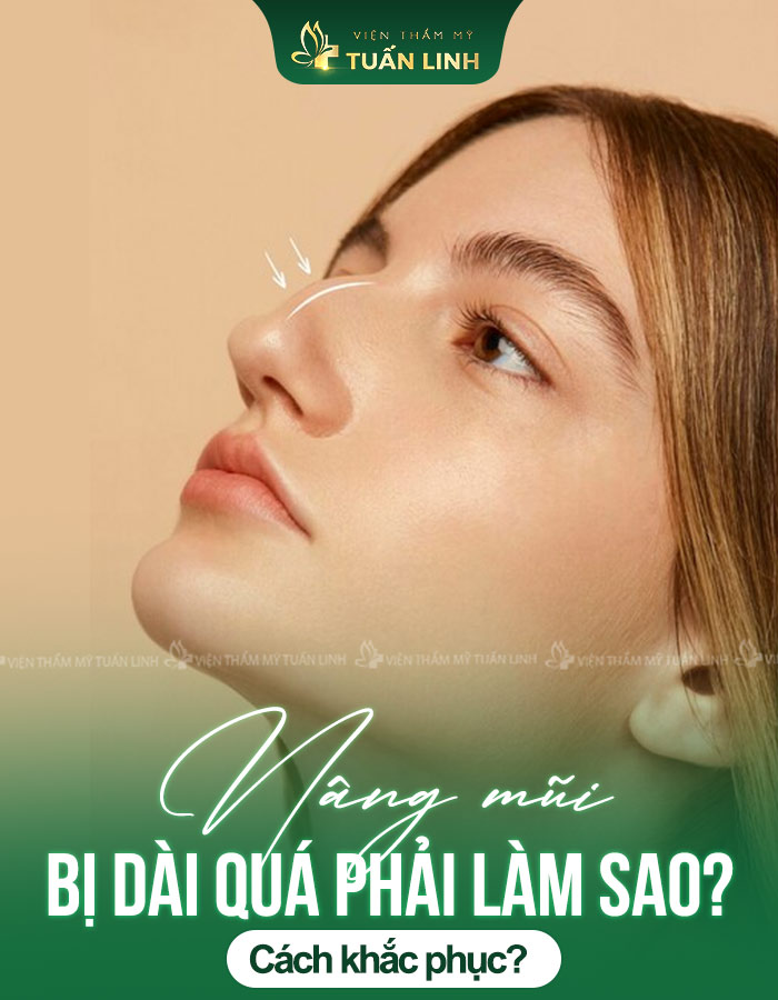 Nâng mũi bị dài quá phải làm sao? Cách khắc phục?