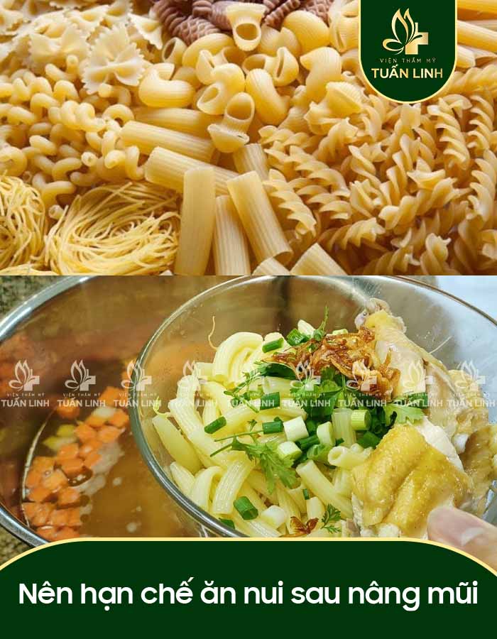 Nên hạn chế ăn nui sau nâng mũi