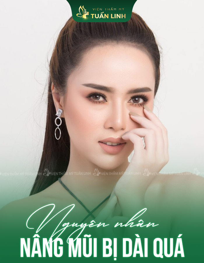 Nguyên nhân nâng mũi bị dài quá