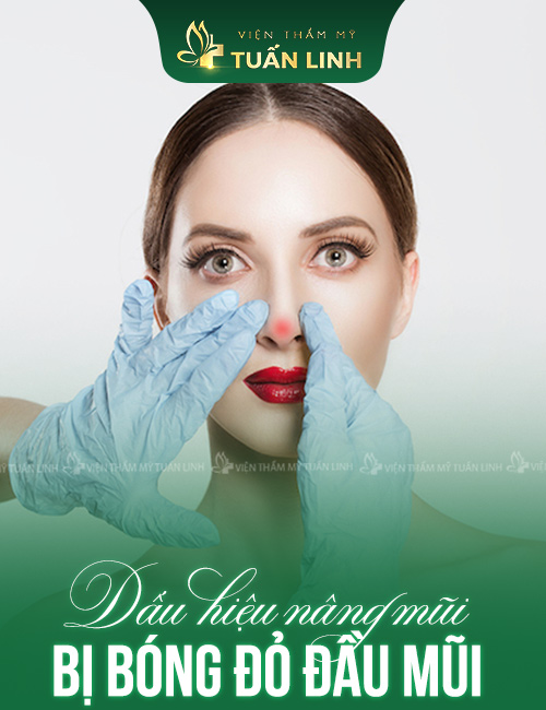 DẤU HIỆU NÂNG MŨI BỊ ĐỎ ĐẦU MŨI