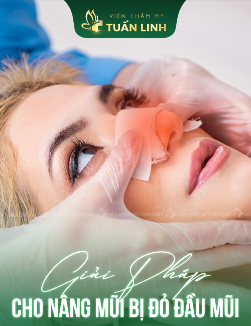 Cảnh báo!!! Nâng mũi bị ĐỎ ĐẦU MŨI - "Bật mí" giải pháp