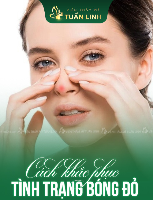 CÁCH KHẮC PHỤC TÌNH TRẠNG BÓNG ĐỎ