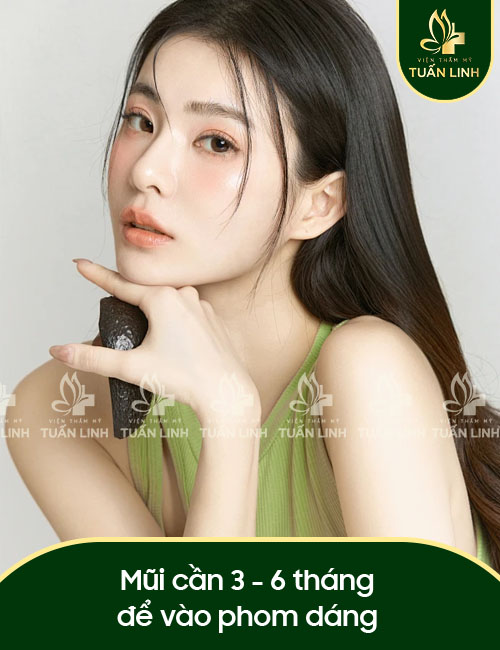Mũi cần 3 - 6 tháng để vào phom dáng