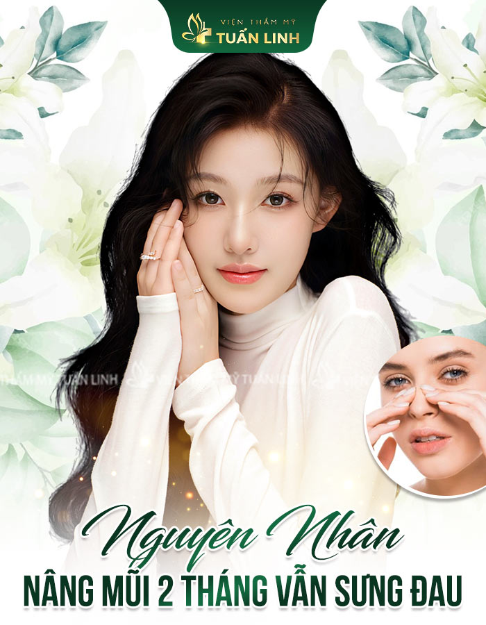 Nguyễn nhân khiến nâng mũi 2 tháng vẫn sưng