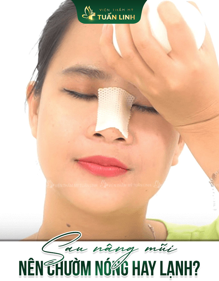 Sau nâng mũi nên chườm nóng hay lạnh?