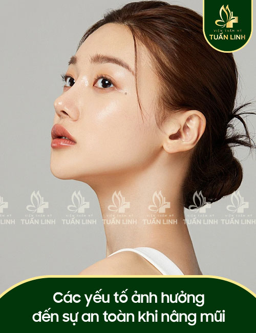 Các yếu tố ảnh hưởng đến sự an toàn khi nâng mũi
