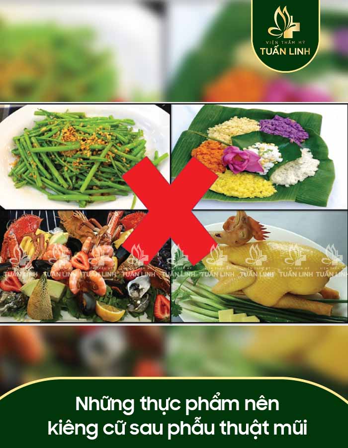 Những thực phẩm nên kiêng cữ sau phẫu thuật mũi