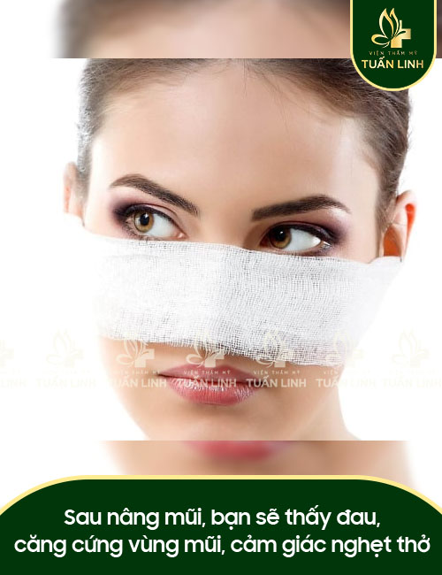 Sau nâng mũi, bạn sẽ thấy đau, căng cứng vùng mũi, cảm giác nghẹt thở