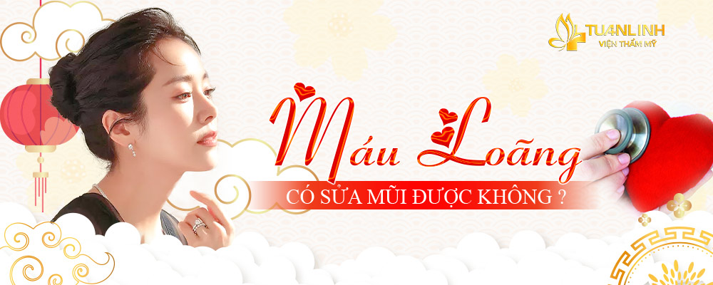 Máu Loãng có Sửa mũi được không? | Tư vấn từ chuyên gia