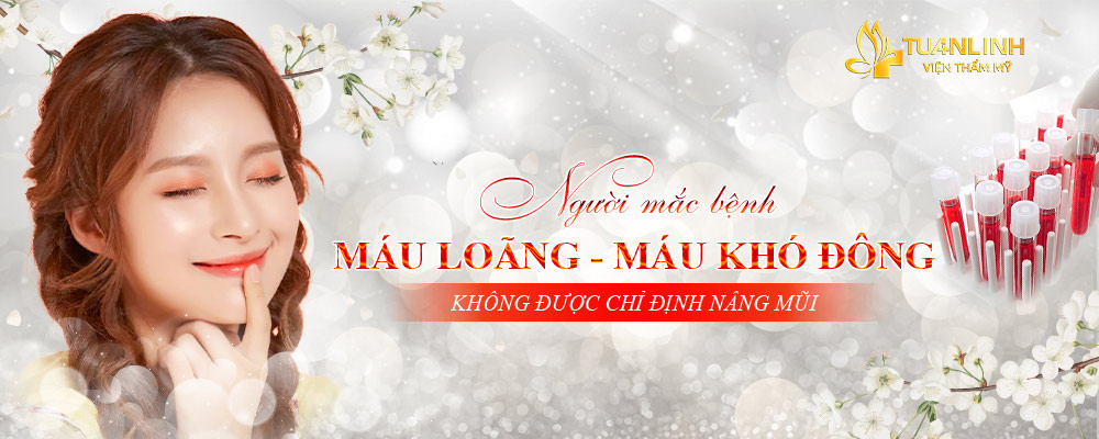 Người mắc bệnh máu loãng, máu khó đông không được chỉ định nâng mũi | Máu Loãng có Sửa mũi được không? | Tư vấn từ chuyên gia