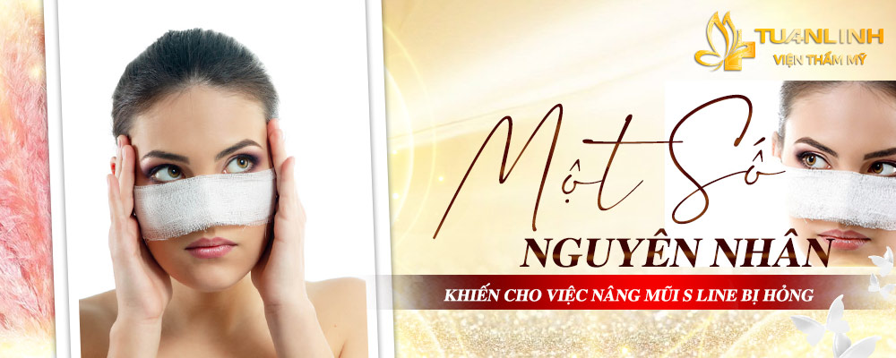 mot so nguyen nhan khien viec nang mui s line bi hong 2
