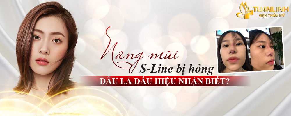 nang mui s line bi hong 1