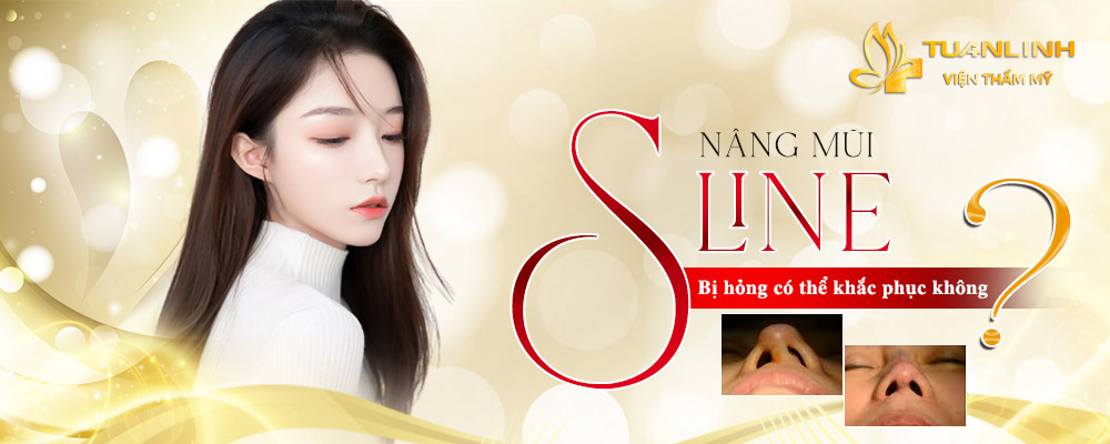 nang mui s line bi hong co xu ly duoc khong 1