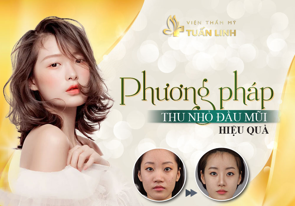 Phương pháp thu nhỏ đầu mũi hiệu quả | Sửa mũi to thành nhỏ