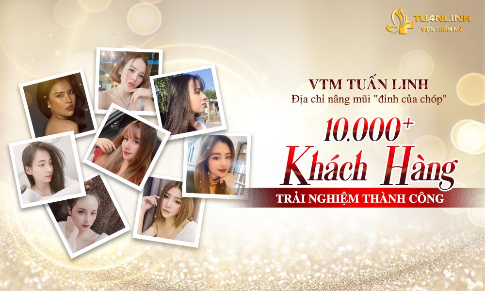 vien tham my tuan linh 1