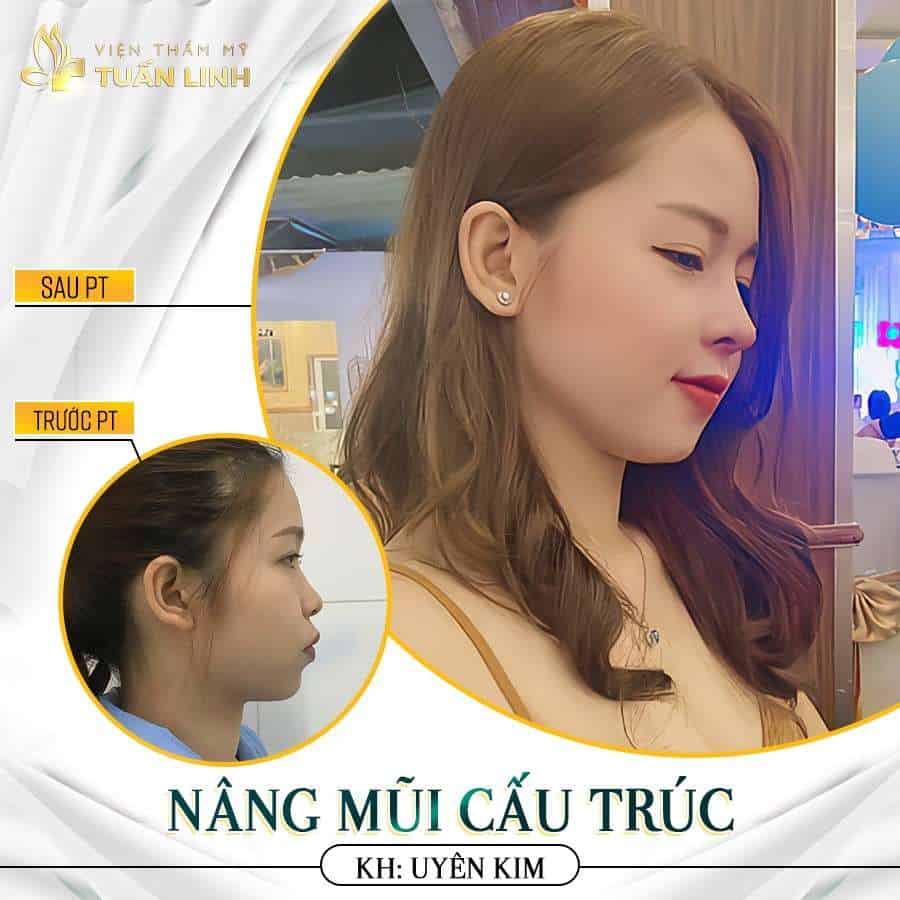cau truc 2 1