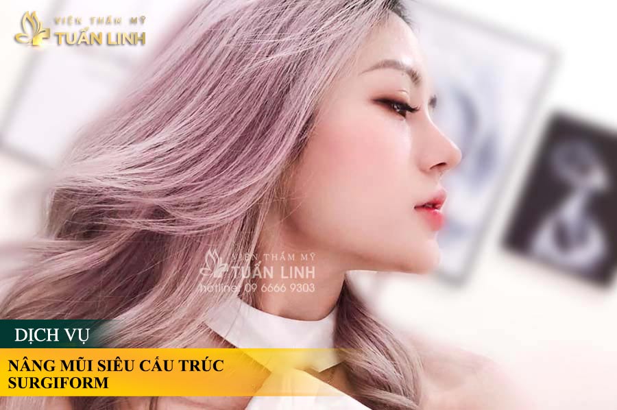Hình ảnh khách hàng sau khi NÂNG MŨI SIÊU CẤU TRÚC