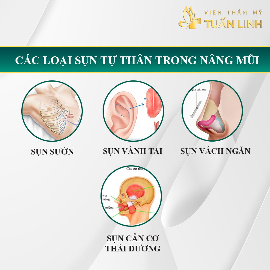  Các loại sụn tự thân trong nâng mũi